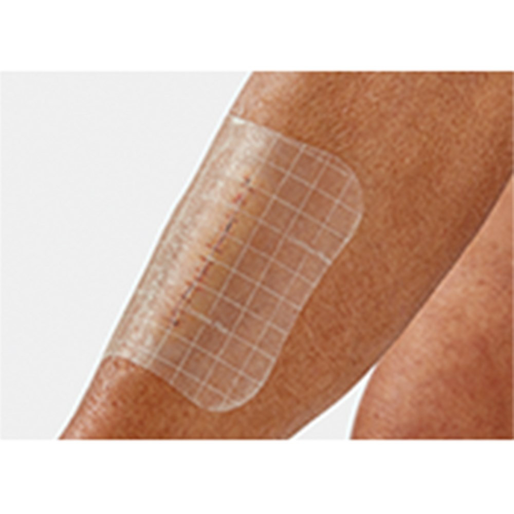 Comfeel Plus Transparent Dressing 5 x 25 Box of 5 - Image 2