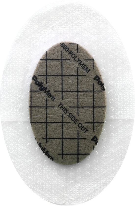 PolyMem Ag Silicone Border Adhesive - Image 2
