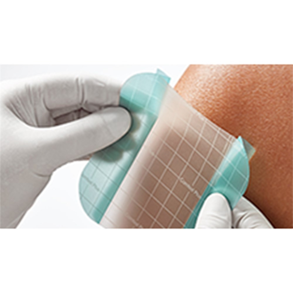 Comfeel Plus Transparent Dressing 5 x 25 Box of 5